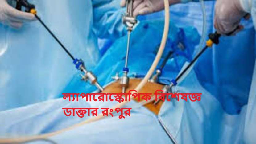ল্যাপারোস্কোপিক বিশেষজ্ঞ ডাক্তার রংপুর